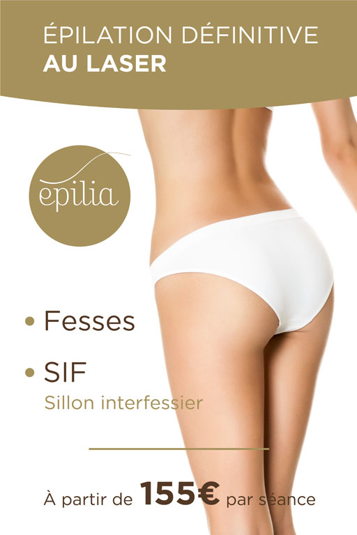 epilation-laser-fesses-sif-charleroi-mob